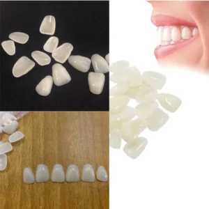 Ultra-Thin Whitening Veneers